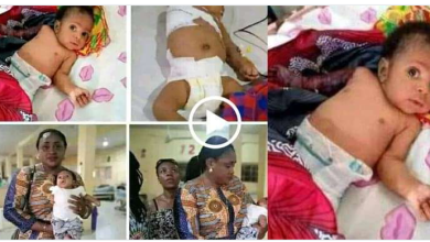 Wani Uba ya fusata yayi sandiyyar cirewa jariri dan wata shida hannu